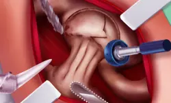 Princess Hips Surgery image